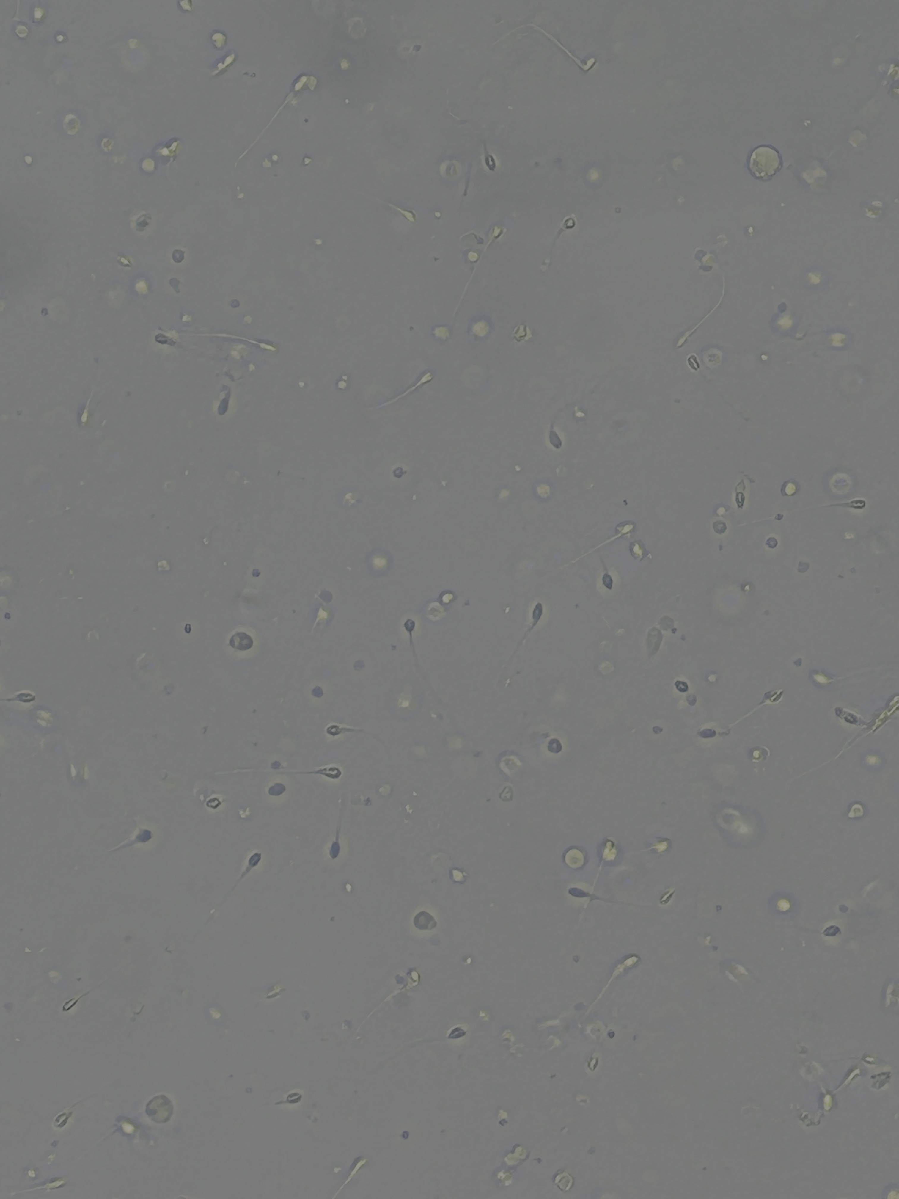 During the program, I also had the chance to observe my own sample under a microscope while learning about microfluidic sperm-sorting research.